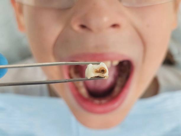 Best After-Hours Emergency Dentist in Hermantown, MN
